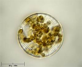 Cyclotella stelligera